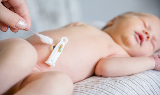 Guia pratico: cuidados com o coto umbilical do bebê